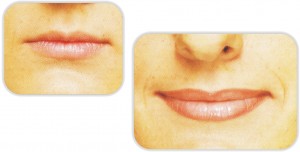 lips01