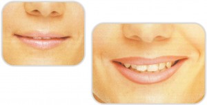 lips02